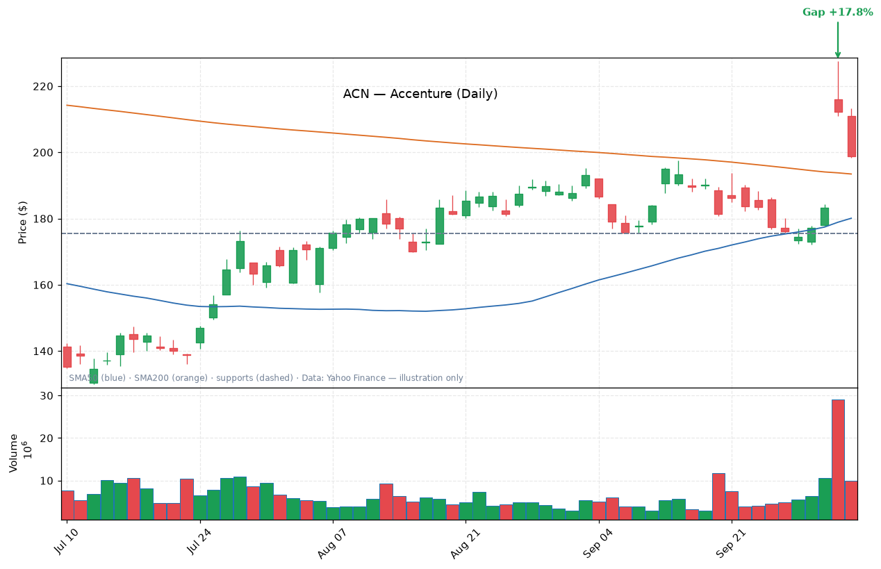 ACN daily candlestick chart